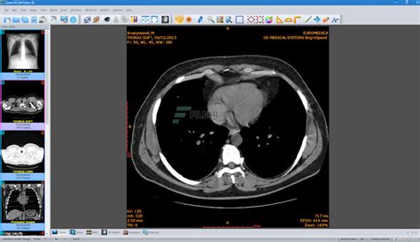 Sante DICOM Editor 3D